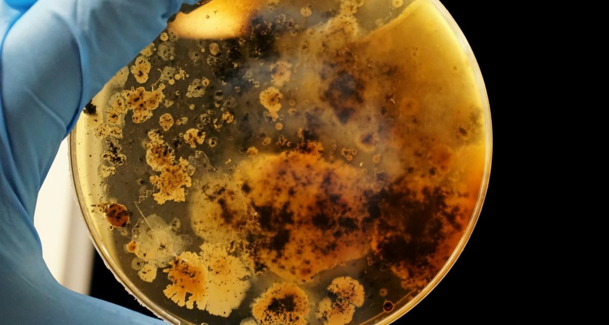 Listériose : Comprendre et prévenir cette infection alimentaire