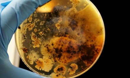 Listériose : Comprendre et prévenir cette infection alimentaire