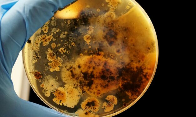 Listériose : Comprendre et prévenir cette infection alimentaire