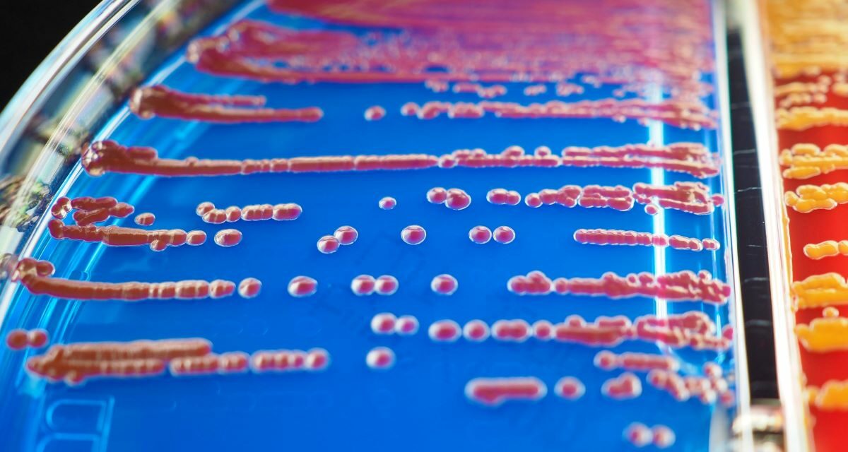Fièvre charbonneuse : symptômes, causes et transmission chez l’homme et l’animal