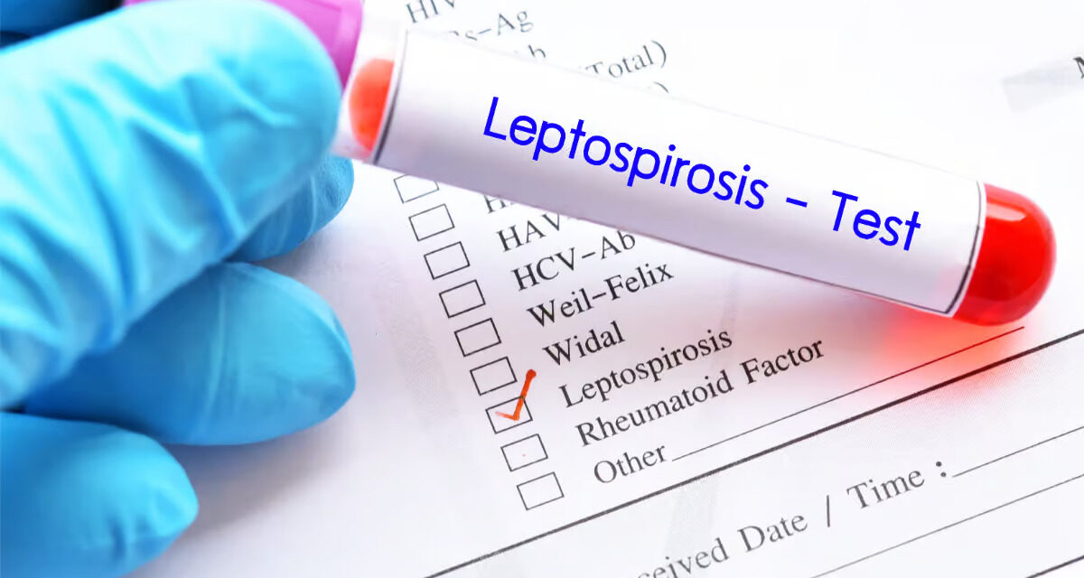 Leptospirose : Une Zoonose négligée aux implications graves